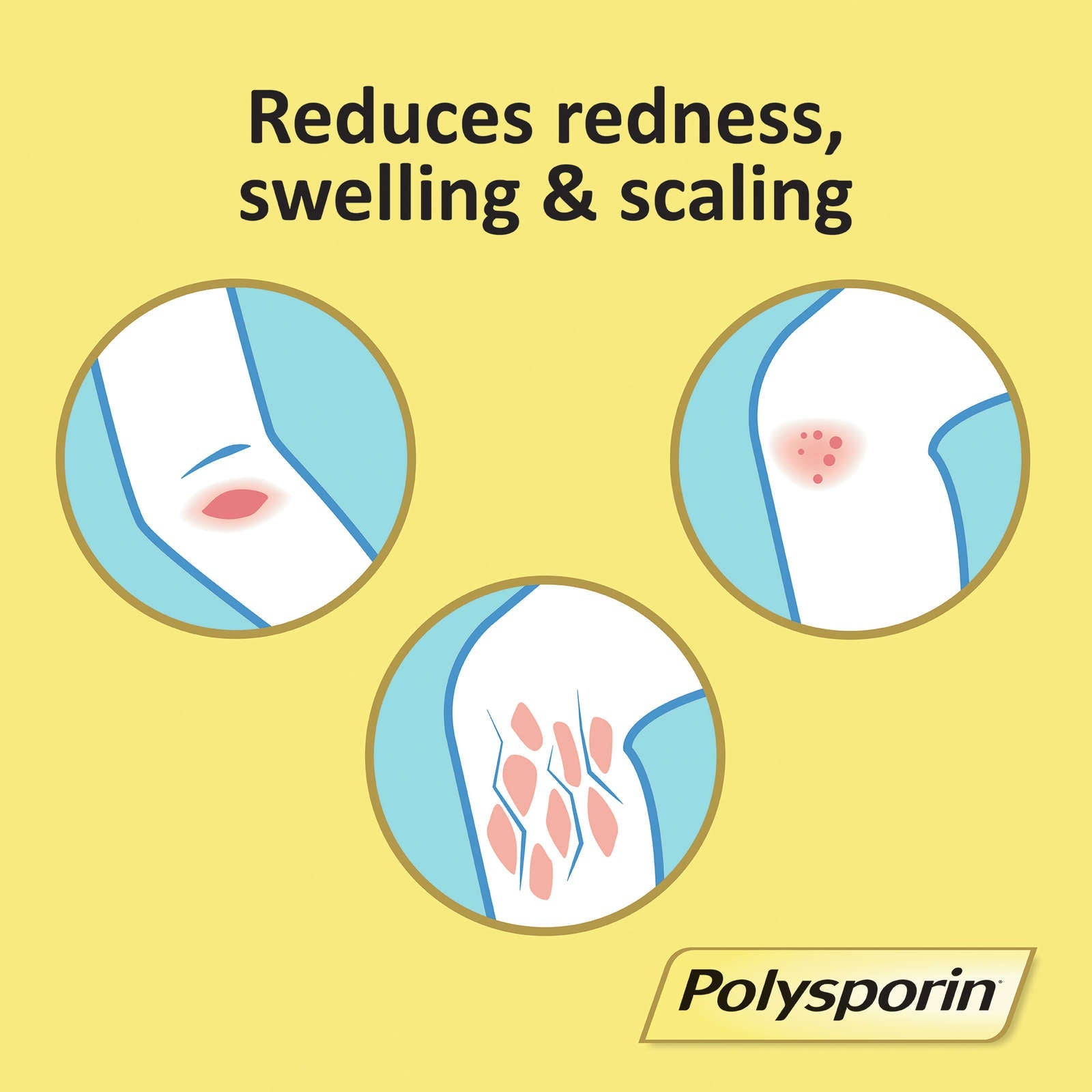 Triple Antibiotic Cream, Heal-Fast Formula