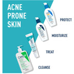 Acne Control Gel