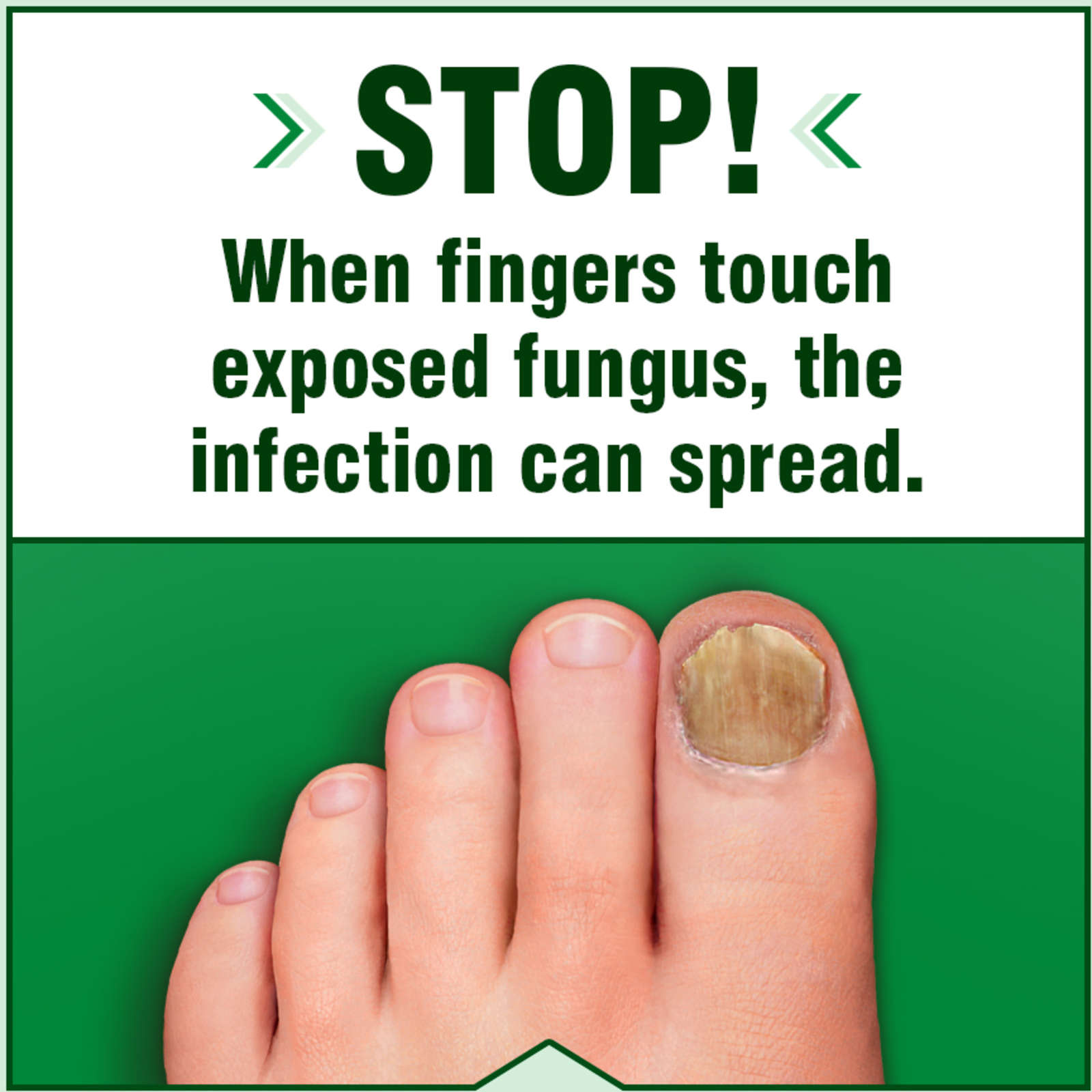 Anti-Fungal Liquid Topical Formula Maximum Strength
