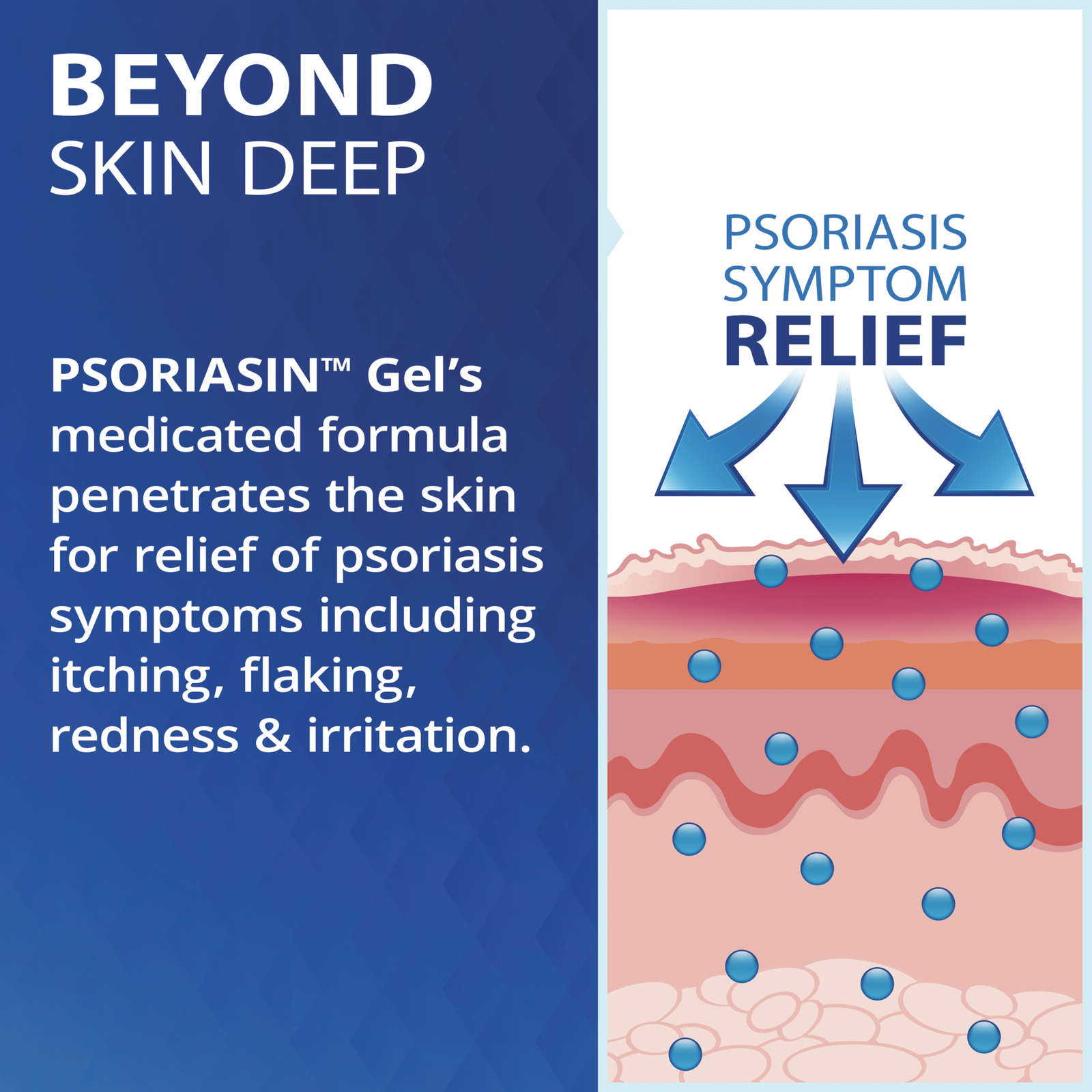 Topical Gel