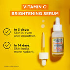 Garnier Vitamin C Face Serum with Salicylic Acid & Niacinamide, Brightening for Dull Skin, 30 mL