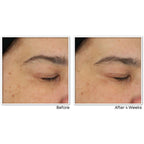 Multi Correxion Revive + Glow Gel Cream