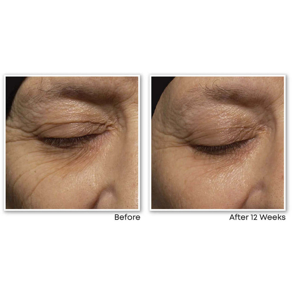 Retinol Correxion Deep Wrinkle Night Cream