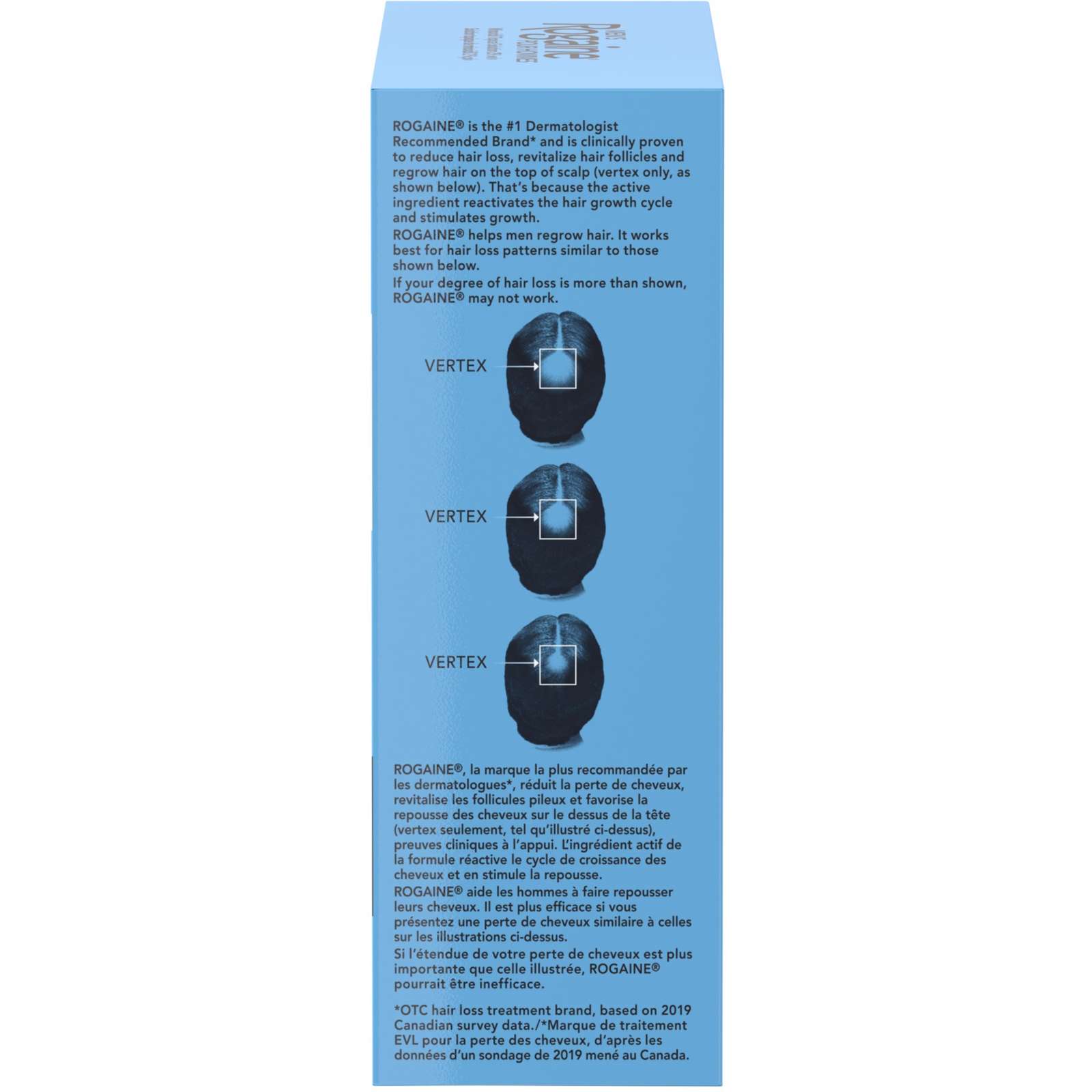 Men's 2% Minoxidil Solution Hair Loss and Regrowth Treatment