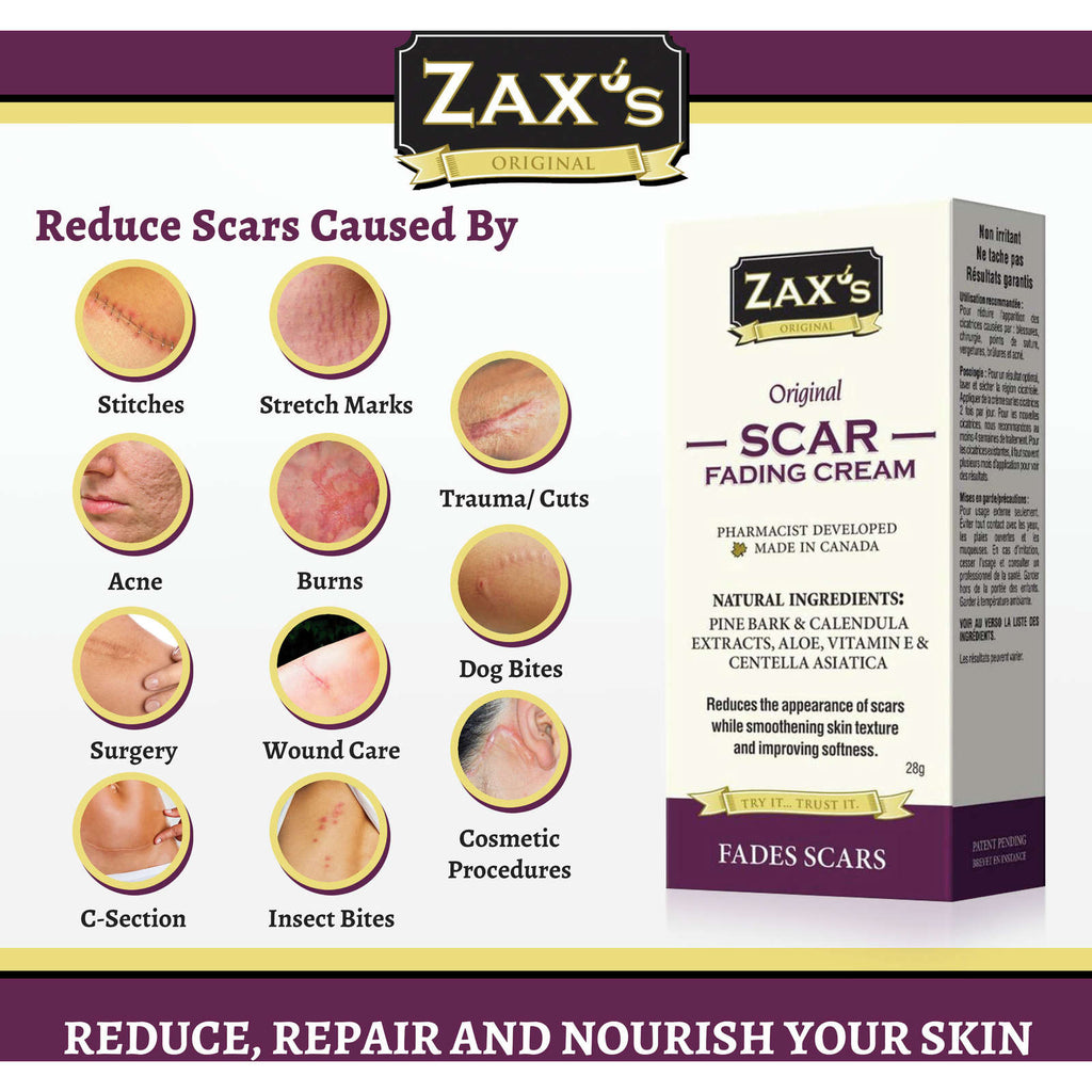 Scar Fading Cream