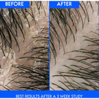 Dry Scalp Anti-Dandruff Shampoo